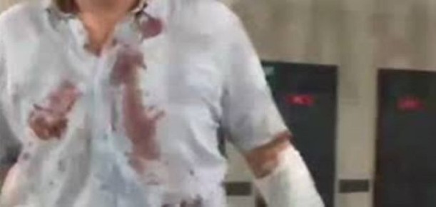 Зверства нацистов в Одессе